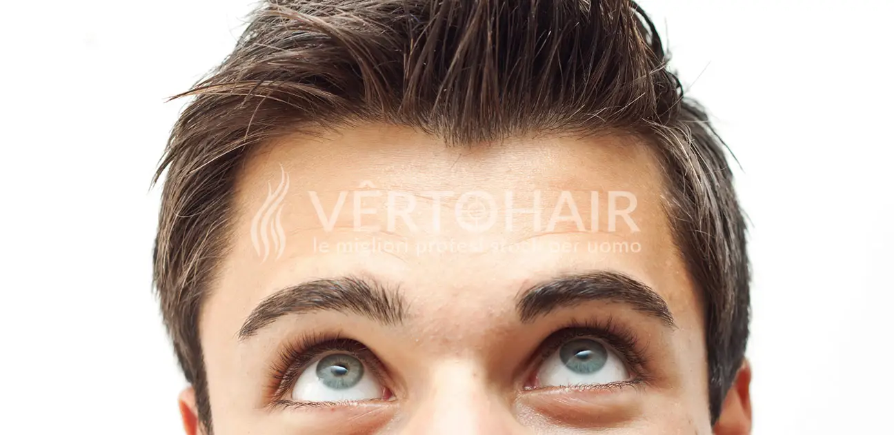 protesi capelli stock