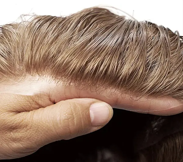 protesi capelli vloop 008